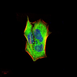 IRAK-M Antibody in Immunocytochemistry (ICC/IF)