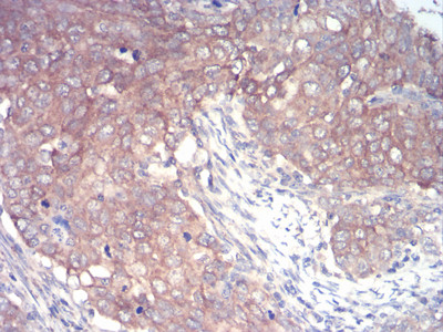 IRAK-M Antibody in Immunohistochemistry (Paraffin) (IHC (P))