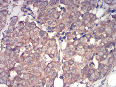 IRAK-M Antibody in Immunohistochemistry (Paraffin) (IHC (P))