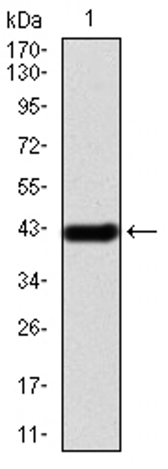 IRAK-M Antibody in Western Blot (WB)