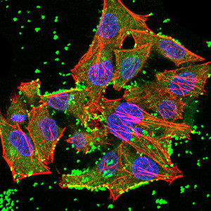 JARID2 Antibody in Immunocytochemistry (ICC/IF)