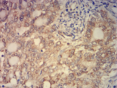 PCAF Antibody in Immunohistochemistry (Paraffin) (IHC (P))