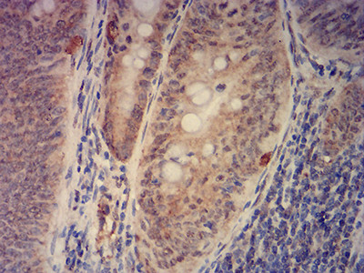 PCAF Antibody in Immunohistochemistry (Paraffin) (IHC (P))