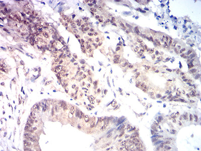 MYST2 Antibody in Immunohistochemistry (Paraffin) (IHC (P))