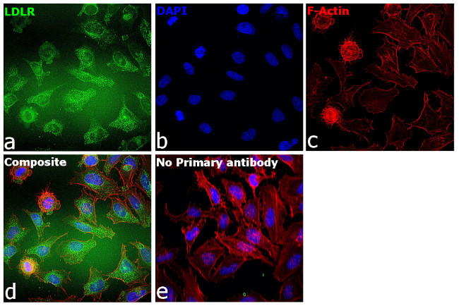 LDLR Antibody in Immunocytochemistry (ICC/IF)