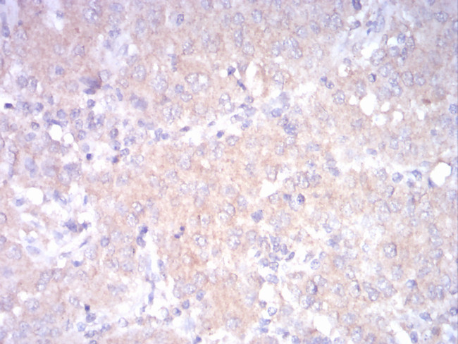 LDLR Antibody in Immunohistochemistry (Paraffin) (IHC (P))