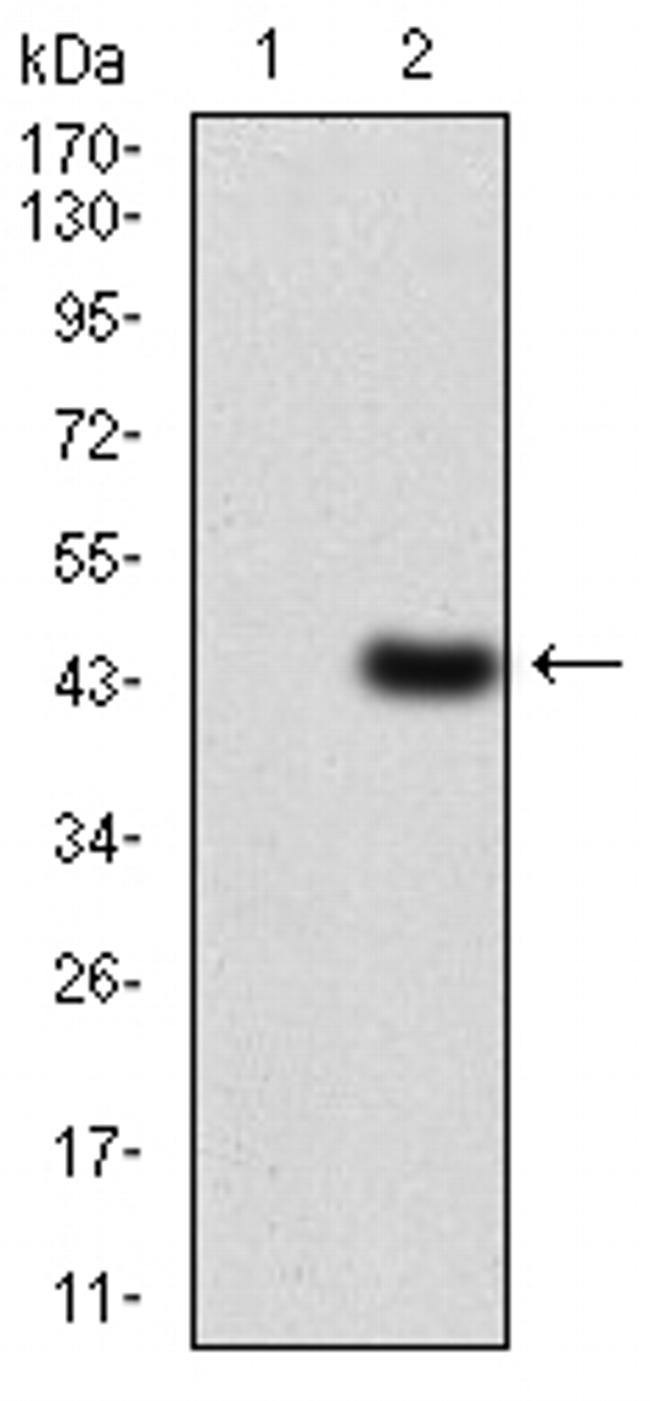 LDLR Antibody in Western Blot (WB)