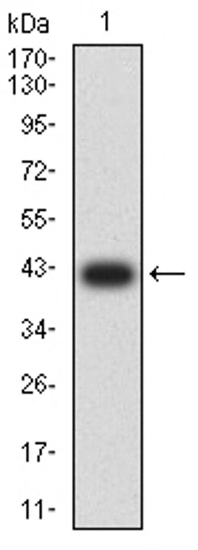 LRP8 Antibody in Western Blot (WB)