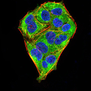 MECP2 Antibody in Immunocytochemistry (ICC/IF)