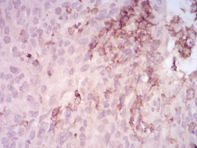 MMP14 Antibody in Immunohistochemistry (Paraffin) (IHC (P))