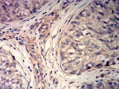 MYLK Antibody in Immunohistochemistry (Paraffin) (IHC (P))