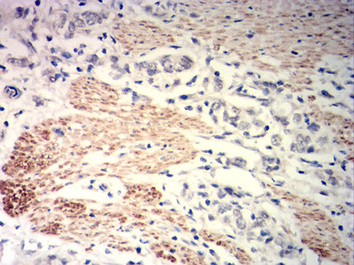 MYLK Antibody in Immunohistochemistry (Paraffin) (IHC (P))