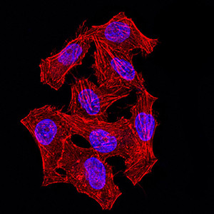 hnRNP M Antibody in Immunocytochemistry (ICC/IF)