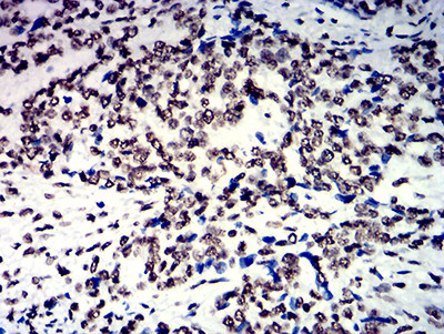 hnRNP M Antibody in Immunohistochemistry (Paraffin) (IHC (P))