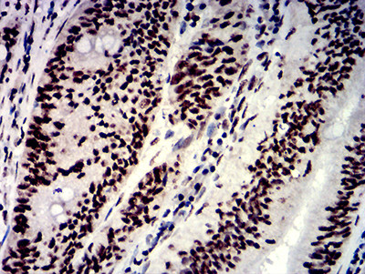 hnRNP M Antibody in Immunohistochemistry (Paraffin) (IHC (P))