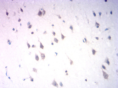 NeuroD1 Antibody in Immunohistochemistry (Paraffin) (IHC (P))