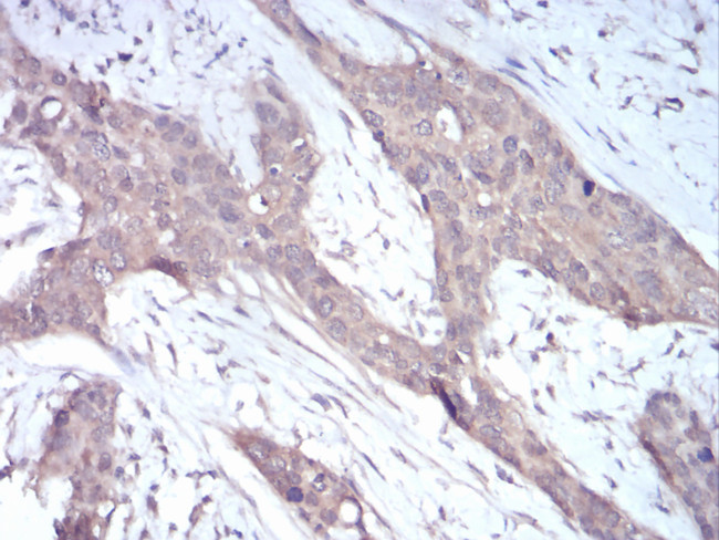 NOX4 Antibody in Immunohistochemistry (Paraffin) (IHC (P))