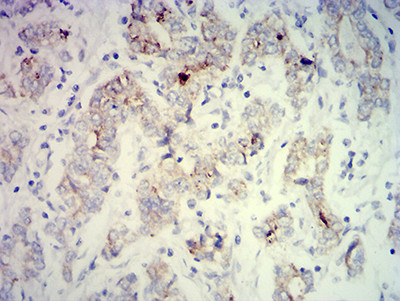 PCK2 Antibody in Immunohistochemistry (Paraffin) (IHC (P))