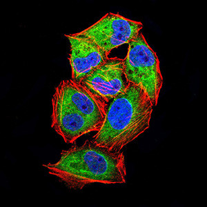 PLA2G7 Antibody in Immunocytochemistry (ICC/IF)