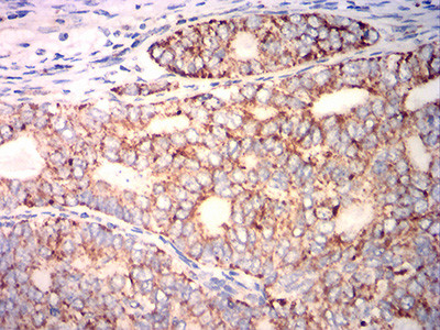 PLA2G7 Antibody in Immunohistochemistry (Paraffin) (IHC (P))