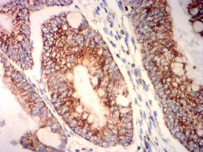 PLA2G7 Antibody in Immunohistochemistry (Paraffin) (IHC (P))