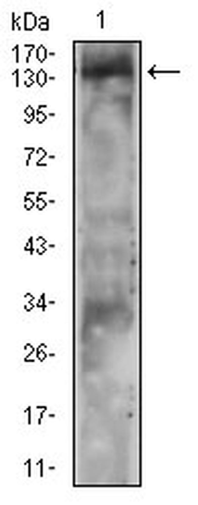 PLCG2 Antibody in Western Blot (WB)