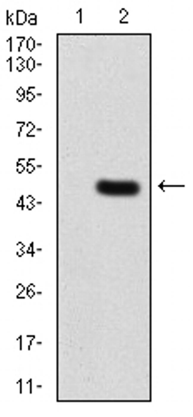 PLCG2 Antibody in Western Blot (WB)