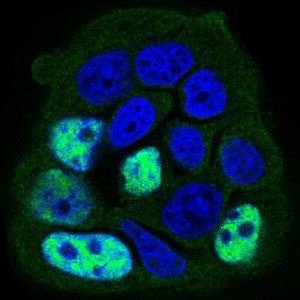 PP1 beta Antibody in Immunocytochemistry (ICC/IF)