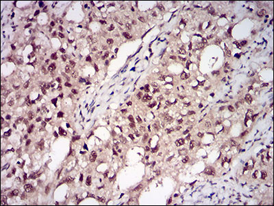 PP1 beta Antibody in Immunohistochemistry (Paraffin) (IHC (P))