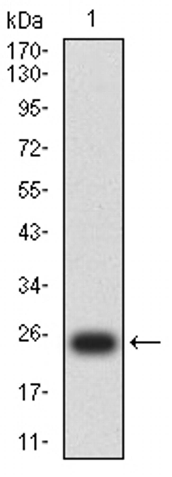 PSAP Antibody in Western Blot (WB)