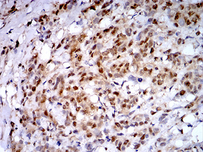 PSMC3 Antibody in Immunohistochemistry (Paraffin) (IHC (P))