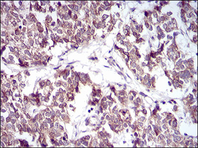 PTP1B Antibody in Immunohistochemistry (Paraffin) (IHC (P))