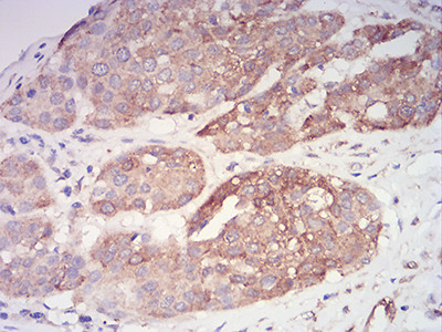 PYCARD Antibody in Immunohistochemistry (Paraffin) (IHC (P))