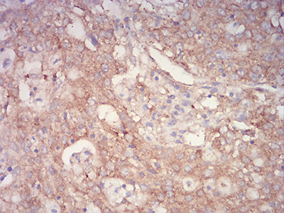 PYCARD Antibody in Immunohistochemistry (Paraffin) (IHC (P))