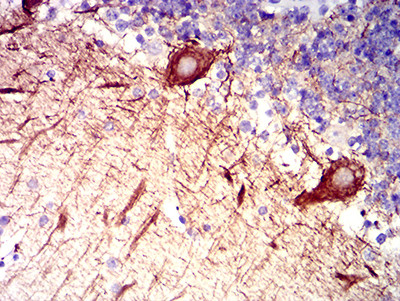 RAB27B Antibody in Immunohistochemistry (Paraffin) (IHC (P))