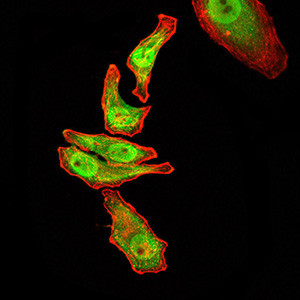 RAN Antibody in Immunocytochemistry (ICC/IF)