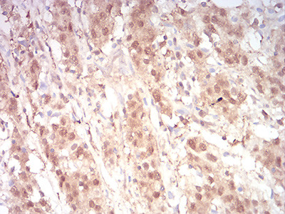 RAN Antibody in Immunohistochemistry (Paraffin) (IHC (P))