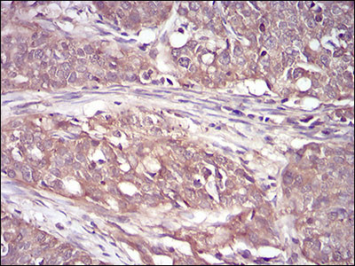 RSK3 Antibody in Immunohistochemistry (Paraffin) (IHC (P))