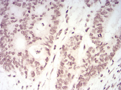 TERT Antibody in Immunohistochemistry (Paraffin) (IHC (P))