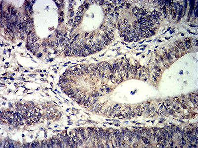 TET2 Antibody in Immunohistochemistry (Paraffin) (IHC (P))