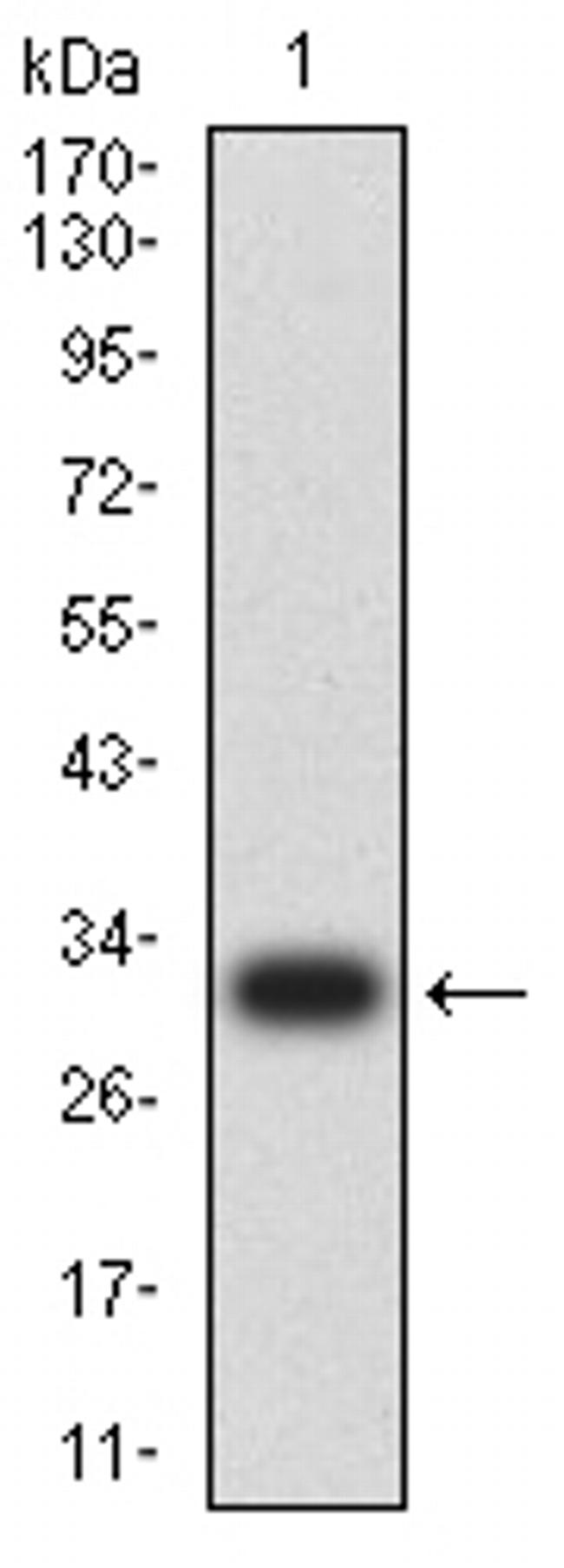 TET2 Antibody in Western Blot (WB)