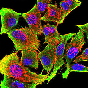 Tyrosine Hydroxylase Antibody in Immunocytochemistry (ICC/IF)