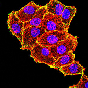 TIA-1 Antibody in Immunocytochemistry (ICC/IF)