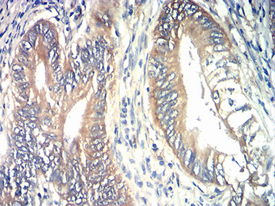 TIA-1 Antibody in Immunohistochemistry (Paraffin) (IHC (P))