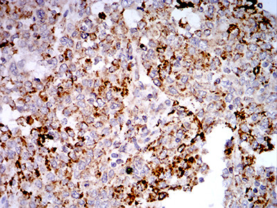 TLR9 Antibody in Immunohistochemistry (Paraffin) (IHC (P))