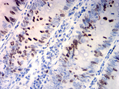 TOP2A Antibody in Immunohistochemistry (Paraffin) (IHC (P))