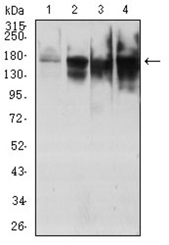 TOP2A Antibody in Western Blot (WB)