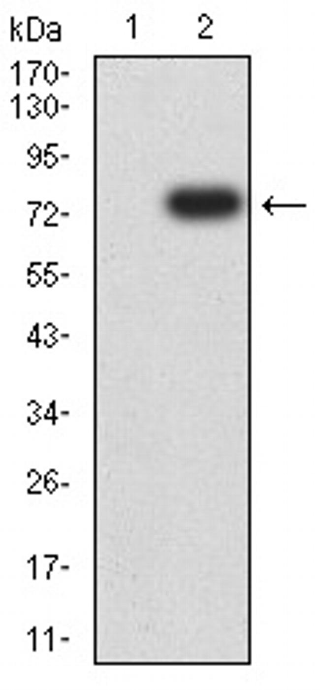 TOP2A Antibody in Western Blot (WB)