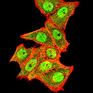 TOP2A Antibody in Immunocytochemistry (ICC/IF)