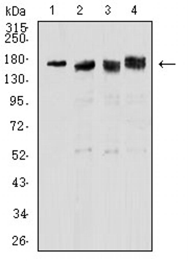 TOP2A Antibody in Western Blot (WB)